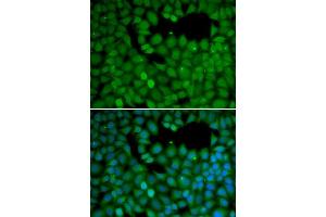 Immunofluorescence analysis of HeLa cells using NET1 antibody (ABIN5970555). (NET1 Antikörper)