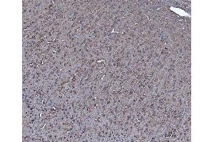 IHC analysis of Dkk1 using anti-Dkk1 antibody (ABIN7602383).