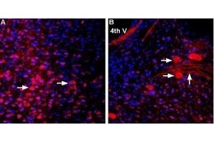 Expression of MCT2 in mouse brain sections - Immunohistochemical staining of perfusion-fixed frozen mouse brain sections using Anti-MCT2 Antibody (ABIN7043678, ABIN7044616 and ABIN7044617), (1:1000). (SLC16A7 Antikörper  (C-Term, Intracellular))