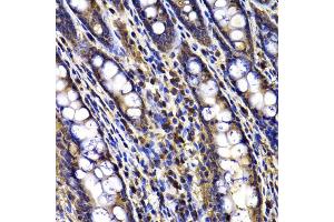 Immunohistochemistry of paraffin-embedded rat ileum using ARID3A antibody (ABIN5975618) at dilution of 1/100 (40x lens). (ARID3A Antikörper)