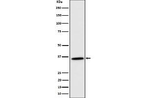 Western Blotting (WB) image for anti-Malate Dehydrogenase 2, NAD (Mitochondrial) (MDH2) antibody (ABIN7607102)