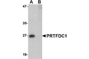 Western Blotting (WB) image for anti-phosphoribosyl Transferase Domain Containing 1 (PRTFDC1) (Middle Region) antibody (ABIN1031049)