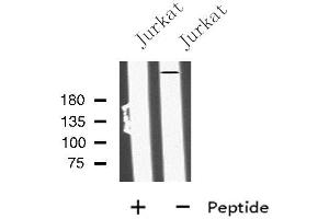 Western blot analysis of MIA3 using Jurkat whole cell lysates (MIA3 Antikörper  (C-Term))