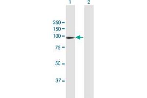 Western Blotting (WB) image for anti-Programmed Cell Death 6 Interacting Protein (PDCD6IP) (AA 1-868) antibody (ABIN950059)