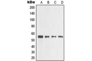 Western blot analysis of MMP3 expression in HeLa (A), A431 (B), mouse heart (C), PC12 (D) whole cell lysates. (MMP3 Antikörper  (C-Term))