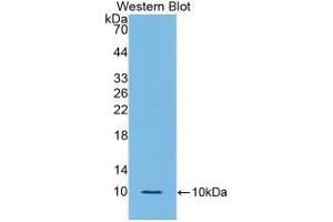 Detection of Recombinant IL6R, Rat using Polyclonal Antibody to Interleukin 6 Receptor (IL6R) (IL-6 Receptor Antikörper  (AA 385-462))