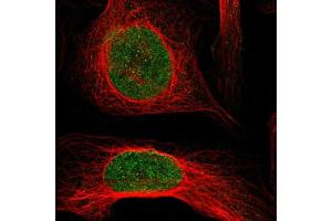 Immunofluorescent staining of U-2 OS cells using KAT5 polyclonal antibody  shows positivity in nucleus (green) but excluded from the nucleoli. (KAT5 Antikörper  (AA 150-286))