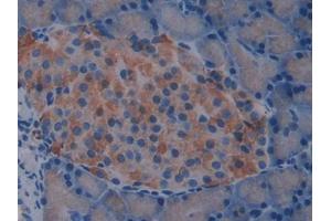 IHC-P analysis of Rat pancrease Tissue, with DAB staining. (IL2 Receptor beta Antikörper  (AA 27-239))