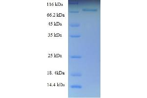 SDS-PAGE (SDS) image for Keratin 8 (KRT8) (AA 2-483) protein (His-SUMO Tag) (ABIN5709835)