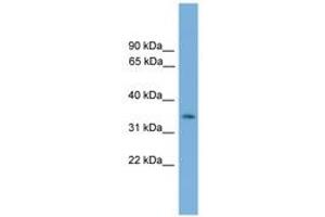 Image no. 1 for anti-NK3 Homeobox 2 (NKX3-2) (AA 151-200) antibody (ABIN6744516) (NKX3-2 Antikörper  (AA 151-200))