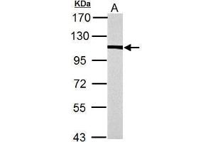 WB Image alpha Actinin 4 antibody [N2C1], Internal detects alpha Actinin 4 protein by Western blot analysis. (alpha Actinin 4 Antikörper)
