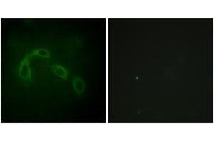 Immunofluorescence analysis of HeLa cells, using PAK1/2 (Ab-199) Antibody. (PAK1/2 Antikörper  (AA 165-214))