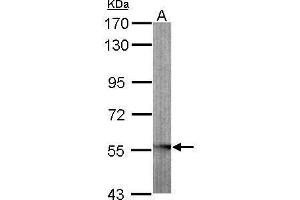 GLYCTK Antikörper