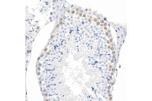 Immunohistochemistry of paraffin-embedded mouse liver using Phospho--S473 Rabbit mAb (ABIN6135179, ABIN6135970, ABIN6135971 and ABIN7101880) at dilution of 1:100 (40x lens). (AKT1 Antikörper  (pSer473))