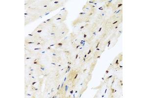 Immunohistochemistry of paraffin-embedded mouse heart using ZBTB17 antibody (ABIN5974597) at dilution of 1/100 (40x lens). (ZBTB17 Antikörper)