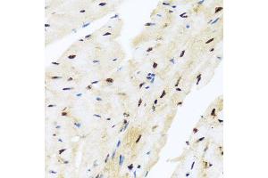 Immunohistochemistry of paraffin-embedded mouse heart using ZBTB17 antibody (ABIN5974597) at dilution of 1/100 (40x lens). (ZBTB17 Antikörper)