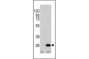 Western blot analysis of HSPB1 (arrow) using rabbit polyclonal HSPB1 Antibody (S78) (R). (HSP27 Antikörper  (AA 56-85))
