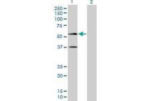 Western Blot analysis of CADM1 expression in transfected 293T cell line by CADM1 MaxPab polyclonal antibody. (CADM1 Antikörper  (AA 1-387))