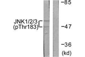 Western blot analysis of extracts from 293 cells treated with UV 5', using JNK1/2/3 (Phospho-Thr183+Tyr185) Antibody. (JNK Antikörper  (pThr183))