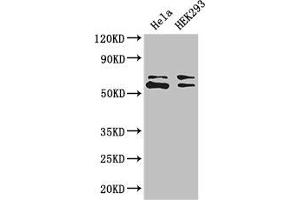 Western Blot Positive WB detected in: Hela whole cell lysate, HEK293 whole cell lysate All lanes: COASY antibody at 3.