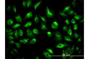 Immunofluorescence of monoclonal antibody to TES on HeLa cell. (TES Antikörper  (AA 1-421))
