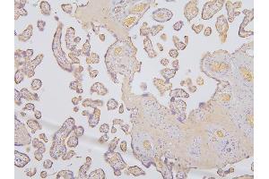 IHC analysis of SLC12A5 using anti-SLC12A5 antibody (ABIN6719415).