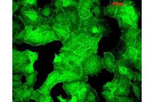 Immunofluorescence staining in HaCaT cells with Psd monoclonal antibody, clone 6G6 . (PSD Antikörper)