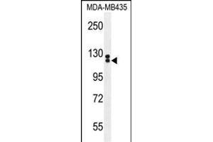 TTLL13 Antibody (Center) (ABIN655432 and ABIN2844968) western blot analysis in MDA-M cell line lysates (35 μg/lane). (TTLL13 Antikörper  (AA 461-490))