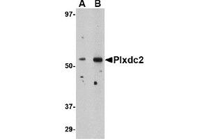 Western Blotting (WB) image for anti-Plexin Domain Containing 2 (PLXDC2) (N-Term) antibody (ABIN1031520) (PLXDC2 Antikörper  (N-Term))