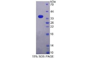 SDS-PAGE analysis of Mouse MRPL2 Protein. (MRPL2 Protein)