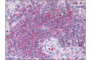 Immunohistochemistry (IHC) image for anti-5-Aminoimidazole-4-Carboxamide Ribonucleotide Formyltransferase/IMP Cyclohydrolase (ATIC) antibody (ABIN264511)