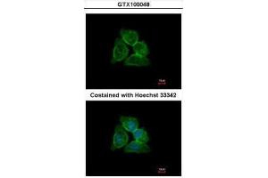 ICC/IF Image Immunofluorescence analysis of methanol-fixed A431, using Annexin A13, antibody at 1:500 dilution.