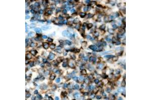 Immunohistochemical analysis of ACVR1B staining in human lymph node formalin fixed paraffin embedded tissue section. (Activin A Receptor Type IB/ALK-4 Antikörper  (Center))