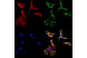 ABIN6261451 and ABIN6266860 staining Hela by IF/ICC.