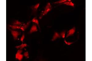 ABIN6269410 staining 293 by IF/ICC.