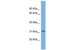 CDCA5 antibody used at 1 ug/ml to detect target protein. (CDCA5 Antikörper  (Middle Region))