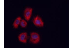 ABIN6258949 and ABIN6273453 staining U-2 OS cells by ICC/IF.