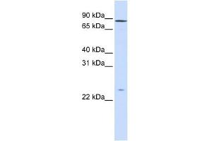 GPSM2 antibody used at 1 ug/ml to detect target protein. (GPSM2 Antikörper)