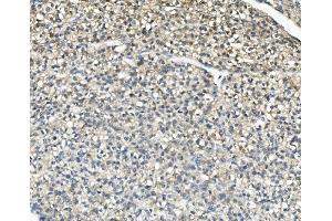 IHC analysis of AKR1D1 using anti-AKR1D1 antibody (ABIN7602975). (AKR1D1 Antikörper  (Middle Region))