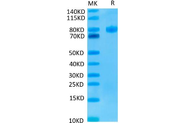 Endoglin Protein (ENG) (His-Avi Tag)