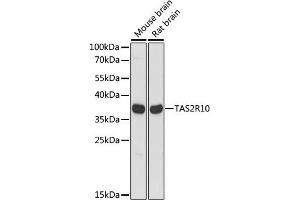 Western blot analysis of extracts of various cell lines, using TR10 antibody (ABIN7270735) at 1:1000 dilution.