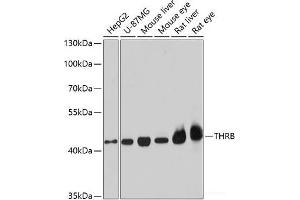 Western blot analysis of extracts of various cell lines using THRB Polyclonal Antibody at dilution of 1:1000. (THRB Antikörper)