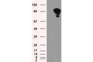 Image no. 3 for anti-Transforming, Acidic Coiled-Coil Containing Protein 3 (TACC3) antibody (ABIN1498099) (TACC3 Antikörper)