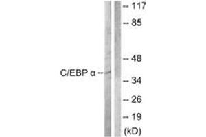 Western blot analysis of extracts from COS7 cells, treated with EGF 200ng/ml 30', using C/EBP-alpha (Ab-222) Antibody.