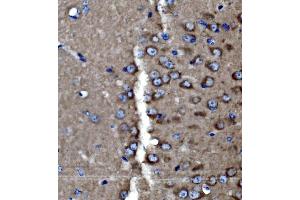 IHC analysis of PAK3 using anti-PAK3 antibody (ABIN7599182). (PAK3 Antikörper  (AA 1-263))