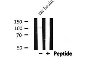 Western blot analysis of NOD1 expression in Rat brain lysate (NOD1 Antikörper  (C-Term))