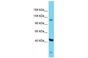 Host:  Rabbit  Target Name:  Zfp445  Sample Type:  Mouse Testis lysates  Antibody Dilution:  1. (ZNF445 Antikörper  (Middle Region))
