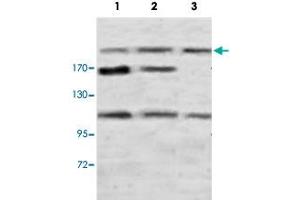 Western blot analysis of rat brain (Lane 1), rat testis (Lane 2) and human fetal kidney (Lane 3) lysate with PLXNB1 polyclonal antibody  at 1 : 500 dilution. (PLXNB1 Antikörper  (N-Term))