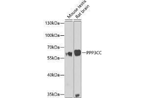 Western blot analysis of extracts of various cell lines, using PPP3CC antibody (ABIN6131416, ABIN6146099, ABIN6146100 and ABIN6223644) at 1:1000 dilution. (PPP3CC Antikörper  (AA 373-512))