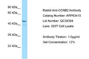 Western Blotting (WB) image for anti-Cyclin B2 (CCNB2) (N-Term) antibody (ABIN2789489) (Cyclin B2 Antikörper  (N-Term))